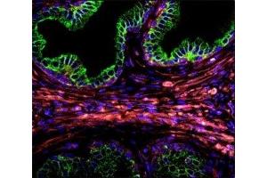 Confocal immunofluorescent analysis of Cytokeratin-18 antibody with prostate carcinoma followed by Alexa Fluor 488-conjugated goat anti-rabbit lgG (green). (Cytokeratin 18 抗体  (AA 401-430))