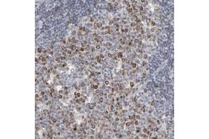 Immunohistochemical staining of human lymph node with VPREB3 polyclonal antibody  shows strong cytoplasmic positivity in reaction center cells.