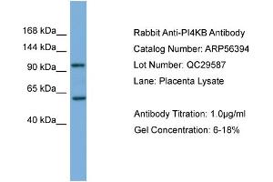 WB Suggested Anti-PI4KB  Antibody Titration: 0.
