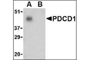 Western blot analysis of PD-1 in THP-1 cell lysate with AP30650PU-N PD1 antibody at 1 μg/ml in the (A) absence and (B) presence of blocking peptide. (PD-1 抗体  (C-Term))