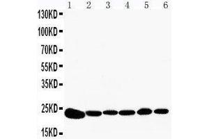 Anti-Peroxiredoxin 2 antibody, Western blotting Lane 1: Rat Brain Tissue Lysate Lane 2: Rat Kidney Tissue Lysate Lane 3: HELA Cell Lysate Lane 4: JURKAT Cell Lysate Lane 5: 293T Cell Lysate Lane 6: A549 Cell Lysate (Peroxiredoxin 2 抗体  (C-Term))