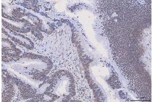 IHC analysis of HnRNP H/HNRNPH1 using anti-HnRNP H/HNRNPH1 antibody (ABIN4886623). (HNRNPH1 抗体  (N-Term))