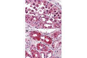 Immunohistochemical (Formalin/PFA-fixed paraffin-embedded sections) staining in human testis (A) and human kidney (B) with NPSR1 polyclonal antibody . (NPSR1 抗体  (2nd Extracellular Domain))