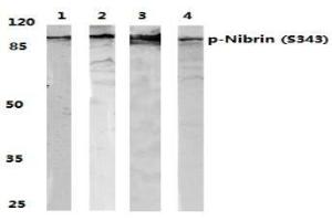 Image no. 1 for anti-Nibrin (NBN) (pSer343) antibody (ABIN318326) (Nibrin 抗体  (pSer343))
