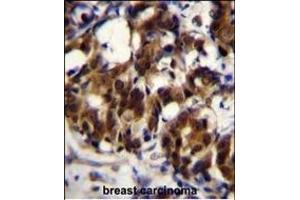 Immunohistochemistry (Paraffin-embedded Sections) (IHC (p)) image for anti-TNFRSF1A-Associated Via Death Domain (TRADD) (AA 126-151) antibody (ABIN655903)