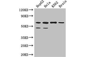 Western Blot Positive WB detected in: HepG2 whole cell lysate, Hela whole cell lysate, K562 whole cell lysate, Mouse brain tissue All lanes: PAF1 antibody at 3. (PAF1/PD2 抗体  (AA 1-300))