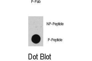 Image no. 1 for anti-Tumor Protein P53 (TP53) (pThr55) antibody (ABIN358423) (p53 抗体  (pThr55))