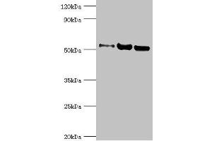 Western blot All lanes: Carbonic anhydrase 1 antibody at 2 μg/mL Lane 1: HepG2 whole cell lysate Lane 2: 293T whole cell lysate Lane 3: 293T whole cell lysate Secondary Goat polyclonal to rabbit IgG at 1/10000 dilution Predicted band size: 53, 14 kDa Observed band size: 53 kDa (G3BP1 抗体  (AA 227-466))