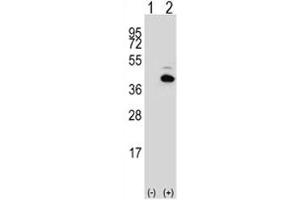 Western Blotting (WB) image for anti-Paired-Like Homeodomain 1 (PITX1) (AA 123-150) antibody (ABIN3032139)