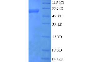 SDS-PAGE (SDS) image for Interleukin 12 beta (IL12B) (AA 23-327) protein (His tag) (ABIN5709731)