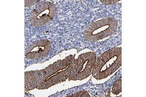 Immunohistochemical staining of human uterine corpus with CPM polyclonal antibody  shows strong membranous and moderate cytoplasmic positivity in glandular cells. (CPM 抗体)