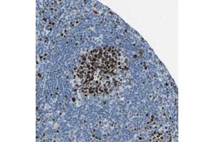 Immunohistochemical staining (Formalin-fixed paraffin-embedded sections) of human lymph node with MCM4 polyclonal antibody  shows strong nuclear positivity in cells in reaction center. (MCM4 抗体)