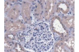 Immunohistochemistry (IHC) image for anti-Calpain 9 (CAPN9) (AA 42-340) antibody (ABIN7444895)