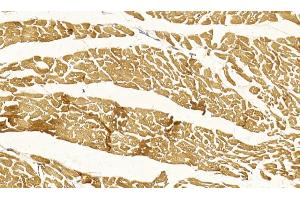 Immunohistochemical analysis of paraffin-embedded Human Myocardium section using Pink1 (ABIN6244160 and ABIN6578849).