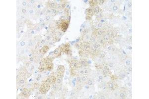 Immunohistochemistry of paraffin-embedded Rat liver using BCL2L2 Polyclonal Antibody at dilution of 1:100 (40x lens). (BCL2L2 抗体)