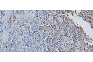 Immunohistochemistry of paraffin-embedded Rat spleen using CCL7 Polyclonal Antibody at dilution of 1:50 (CCL7 抗体)