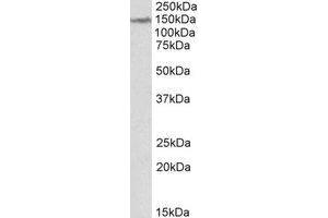 AP22387PU-N LMTK2 antibody staining of Human Cerebellum lysate at 2 µg/ml (35µg protein in RIPA buffer). (LMTK2 抗体  (Internal Region))