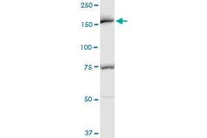 EEA1 polyclonal antibody (A01), Lot # 060717JCS1. (EEA1 抗体  (AA 1312-1411))