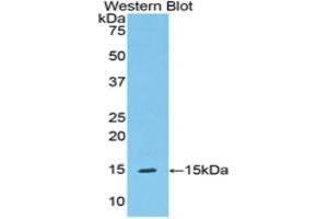 Western Blotting (WB) image for anti-Serpin Peptidase Inhibitor, Clade G (C1 Inhibitor), Member 1 (SERPING1) (AA 211-331) antibody (ABIN3208987) (SERPING1 抗体  (AA 211-331))