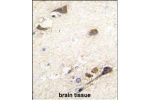 Immunohistochemistry (Paraffin-embedded Sections) (IHC (p)) image for anti-Acetylcholinesterase (AChE) (AA 147-175), (N-Term) antibody (ABIN392325)