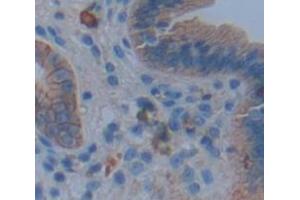 IHC-P analysis of Human Tissue, with DAB staining. (IL17RA 抗体  (AA 33-172))