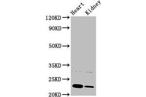 Western Blot Positive WB detected in: Rat heart tisue, Rat kidney tissue All lanes: PTPMT1 antibody at 3 μg/mL Secondary Goat polyclonal to rabbit IgG at 1/50000 dilution Predicted band size: 23, 16, 17 kDa Observed band size: 23 kDa (PTPMT1 抗体  (AA 28-201))