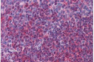 Human Tonsil: Formalin-Fixed, Paraffin-Embedded (FFPE) (ERK1/2 抗体)
