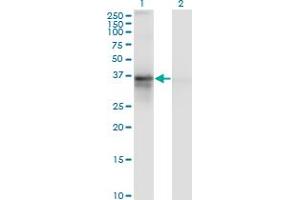 Western Blot analysis of RP2 expression in transfected 293T cell line by RP2 monoclonal antibody (M02), clone 5C10. (RP2 抗体  (AA 251-350))