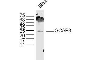 Siha lysates probed with GCAP3 Polyclonal Antibody, Unconjugated  at 1:300 dilution and 4˚C overnight incubation. (GUCA1C 抗体  (AA 141-209))