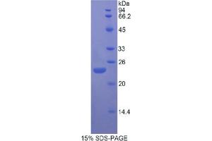 SDS-PAGE analysis of Rat FGF13 Protein. (FGF13 蛋白)