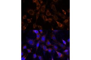 Immunofluorescence analysis of NIH-3T3 cells using VPS25 Polyclonal Antibody (ABIN6128913, ABIN6150122, ABIN6150123 and ABIN6217011) at dilution of 1:100 (40x lens). (VPS25 抗体  (AA 1-176))