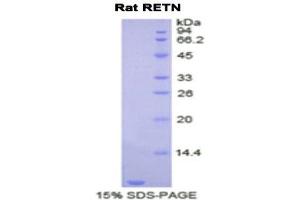 SDS-PAGE (SDS) image for Resistin (RETN) (AA 45-114) protein (His tag) (ABIN1878214) (Resistin Protein (RETN) (AA 45-114) (His tag))
