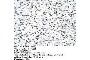 Rabbit Anti-SURF6 Antibody  Paraffin Embedded Tissue: Human Heart Cellular Data: Myocardial cells Antibody Concentration: 4. (SURF6 抗体  (Middle Region))