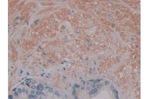 Immunohistochemistry (IHC) image for anti-Protein Kinase (CAMP-Dependent, Catalytic) Inhibitor beta (PKIB) (AA 8-76) antibody (ABIN7443077)