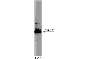 Western Blotting (WB) image for anti-Glutathione S-Transferase pi 1 (GSTP1) (AA 5-210) antibody (ABIN968135) (GSTP1 抗体  (AA 5-210))