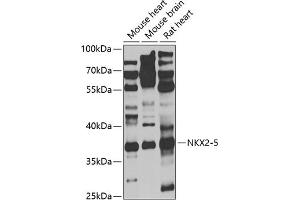 Western blot analysis of extracts of various cell lines, using NKX2-5 antibody (ABIN6132412, ABIN6144644, ABIN6144646 and ABIN6221293) at 1:1000 dilution. (NK2 Homeobox 5 抗体  (AA 1-135))