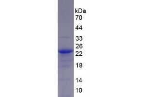 SDS-PAGE analysis of Human Glucose Transporter 1 Protein. (GLUT1 蛋白)