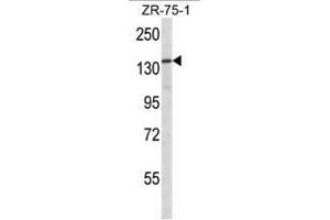 ATAD2 Antibody (N-term) western blot analysis in ZR-75-1 cell line lysates (35µg/lane). (ATAD2 抗体  (N-Term))