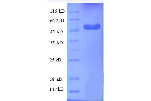 WDR1 Protein (AA 189-461, partial) (GST tag)