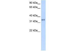 Carbonic Anhydrase IV antibody used at 1 ug/ml to detect target protein. (CA4 抗体  (C-Term))