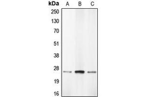 Western blot analysis of Caspase 1 expression in THP1 (A), HL60 (B), BAEC (C) whole cell lysates. (Caspase 1 抗体  (Center))