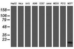Image no. 2 for anti-Cellular Retinoic Acid Binding Protein 2 (CRABP2) antibody (ABIN1497621) (CRABP2 抗体)