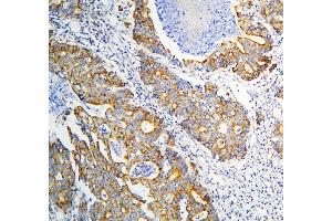 IHC analysis of DARS2 using anti-DARS2 antibody (ABIN6719279).