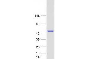 Western Blotting (WB) image for STAM Binding Protein (STAMBP) (Transcript Variant 3) protein (Myc-DYKDDDDK Tag) (ABIN2732753)