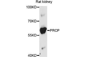 Western blot analysis of extract of rat kidney cells, using PRCP antibody.