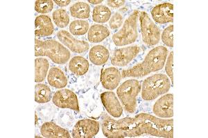 Immunohistochemistry (IHC) image for anti-Dopa Decarboxylase (Aromatic L-Amino Acid Decarboxylase) (DDC) (AA 1-100) antibody (ABIN1679510)