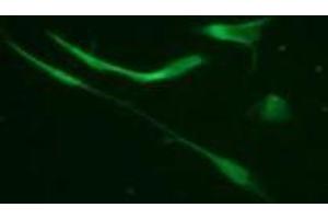 Immunofluorescence (IF) image for anti-Vimentin (VIM) (pSer33) antibody (ABIN1449152)