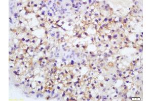 Formalin-fixed and paraffin embedded mouse placenta labeled with Rabbit Anti-Endothelial Lipase Polyclonal Antibody, Unconjugated  at 1:200 followed by conjugation to the secondary antibody and DAB staining (LIPG 抗体  (AA 1-500))