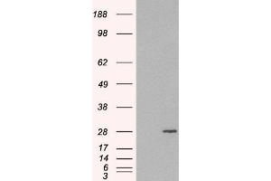 HEK293 overexpressing RAB11A(ABIN5362200) and probed with ABIN184807 (mock transfection in first lane). (RAB11A 抗体  (C-Term))