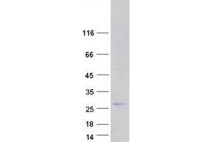 Western Blotting (WB) image for F-Box Protein 36 (FBXO36) protein (Myc-DYKDDDDK Tag) (ABIN2720957)